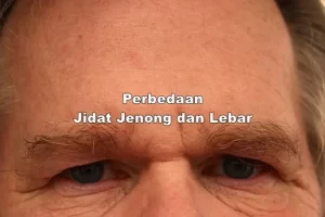 Perbedaan Jidat Jenong dan Lebar